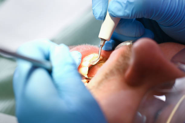 Best Emergency Root Canal Treatment in Oradell, NJ