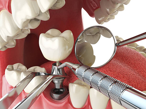 Best Emergency Cosmetic Dentistry in Oradell, NJ